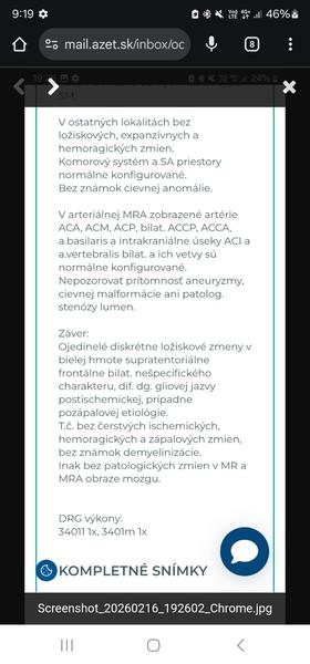 Čo znamenajú moje výsledky z MRI mozgu?