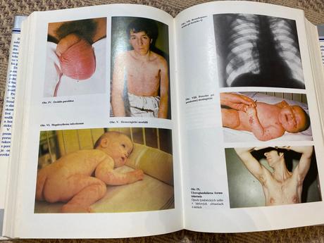 Vnútorné lekárstvo 2 dionýz dieška kolektív autor,