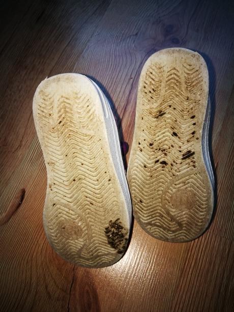 Členkové platenky, protetika,24