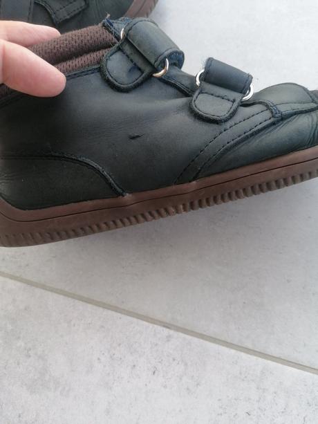 Prechodné protetika, protetika,35