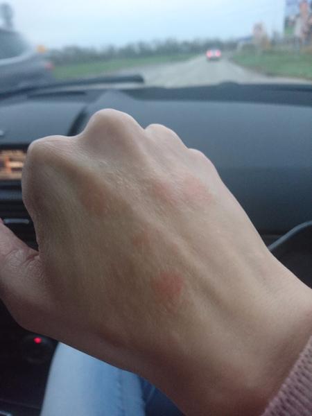 Kožná lekárka v Pezinku