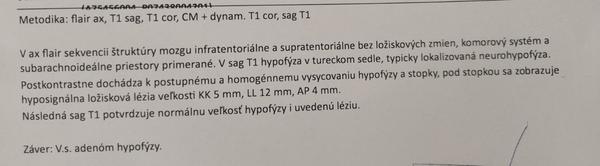Čo znamenajú moje výsledky z MRI?
