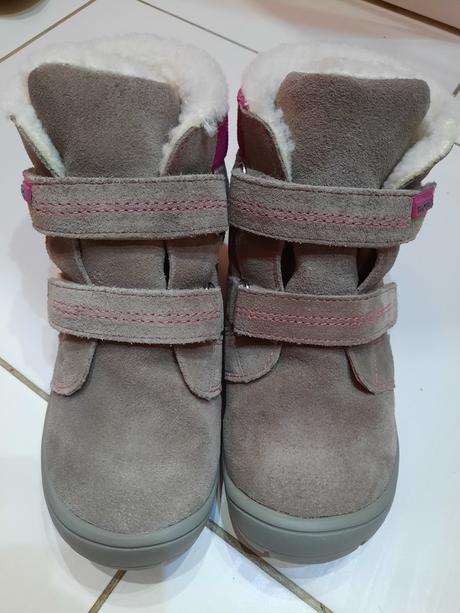 Zimné čižmy protetika, protetika,32