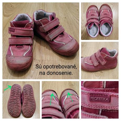 Na donosenie, protetika,31