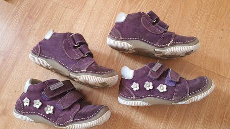 Protetika topanky, protetika,25