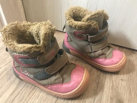 Zimne topanky protetika, protetika,24