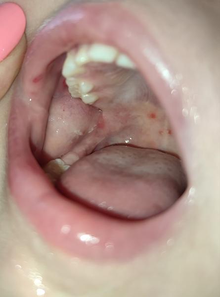 Kiahne v puse škôlkara