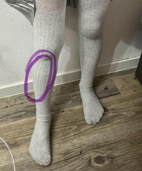 Môžu rastové bolesti postihnúť aj predkolenie detí?