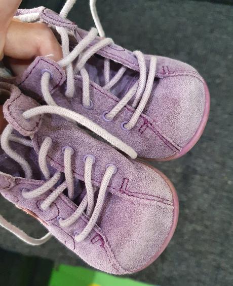 Ortopedicke topanocky protetika, protetika,18