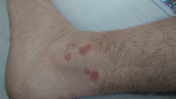 Z čoho pochádza tento štípanec?