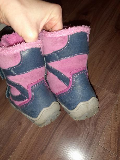 Čižmy sú, protetika,32