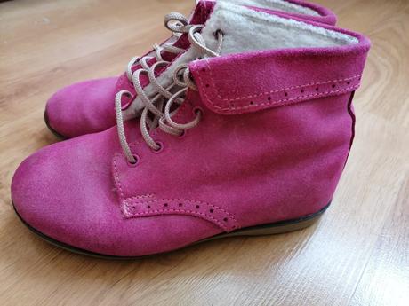 Kotnicky, protetika,30