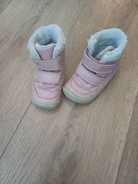 Topanky, protetika,24