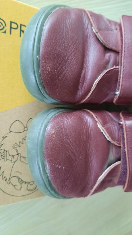 Prechodne barefoot topanky, protetika,31