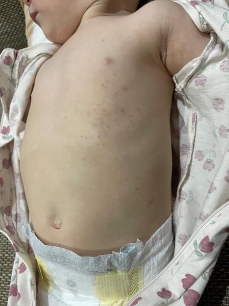 Može to byt z nejakej potraviny?