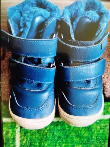 Topánočky protetika, protetika,23