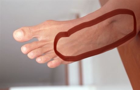 Bolesť nohy v tehotenstve: Aké sú príčiny?