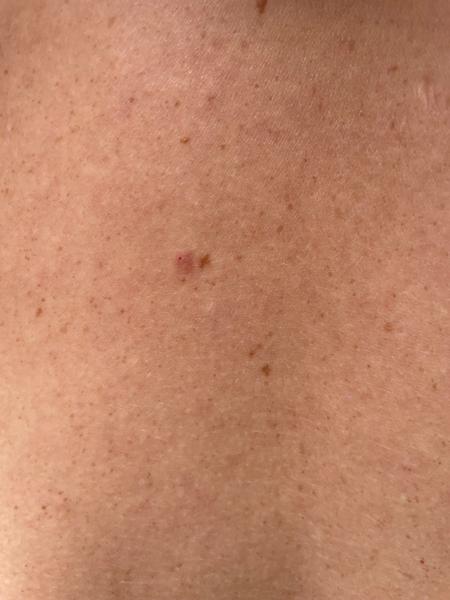 Mám úzkosť z chorôb v rodine a ničím nám sny