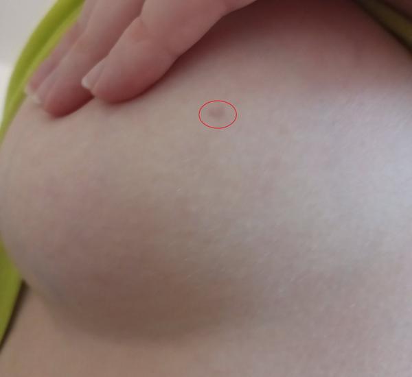 Čo to mám na prsníku?