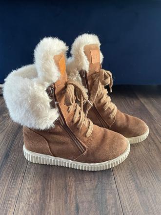 Teplucke, protetika,30