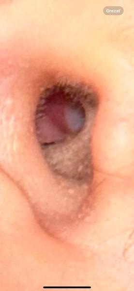 Čo znamená biela škvrna v uchu?