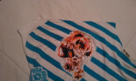 Asymetrický topík, xl