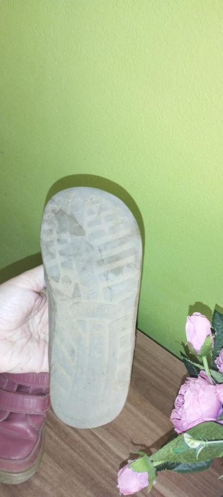 Prechodné barefoot topánky protetika, protetika,27