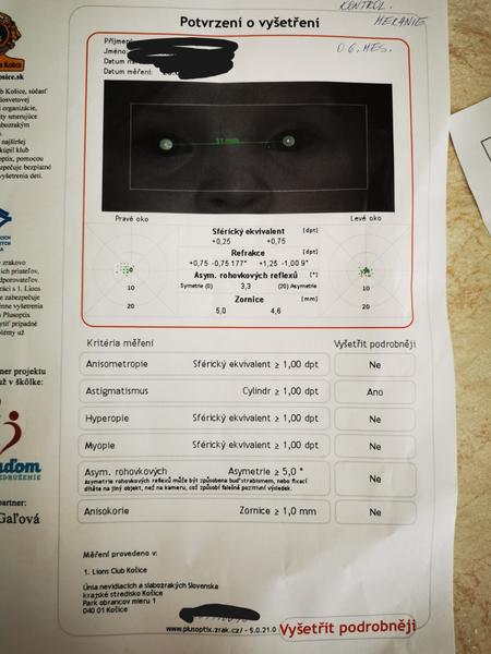 Ako sa lieči astigmatizmus u škôlkárov?
