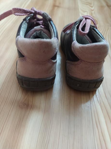 Dievcenske topanky protetika, protetika,22