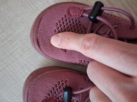 Barefoot tenisky, protetika,23