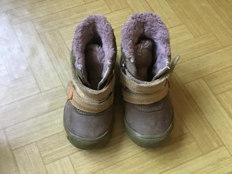 Zimné čižmy protetika, protetika,22
