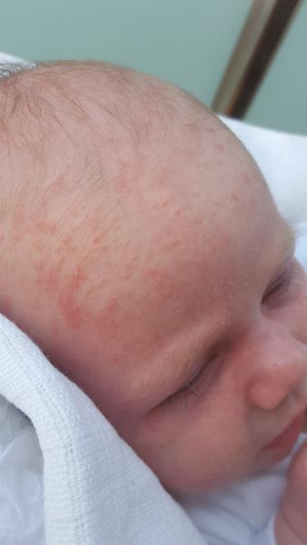 Poraďte čo to má na tváričke a dekolte?