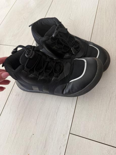 Protetika, protetika,34