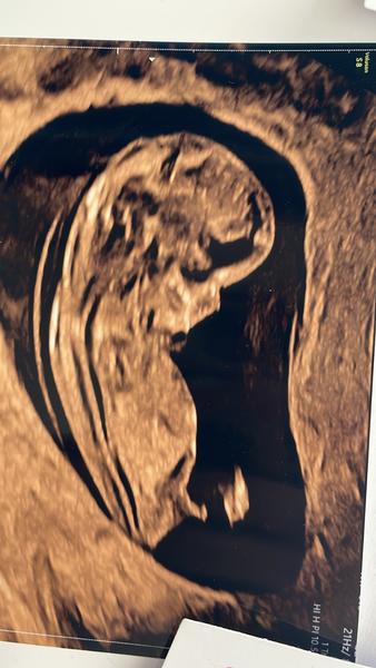 Bude to dievča alebo chlapec?