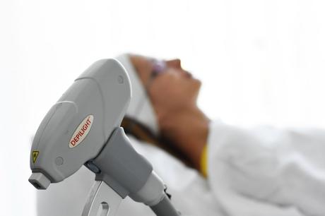 Laserová epilácia nežiaduceho ochlpenia,