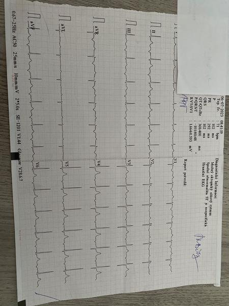EKG - výsledky