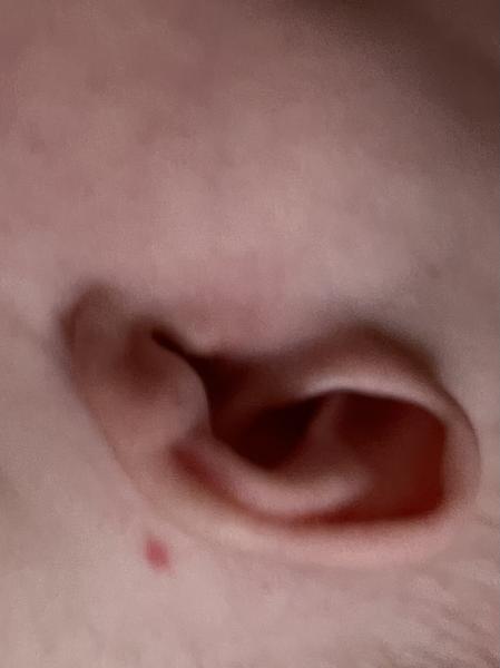 Ružová vyrážka za uškom bábätka