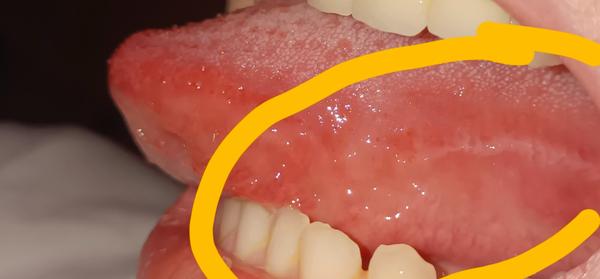 Čo to mám na jazyku?