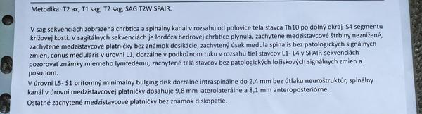 Aké sú moje výsledky z MR - LS chrbtice?