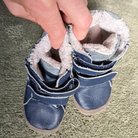 Prechodne topanky protetika 26, protetika,26