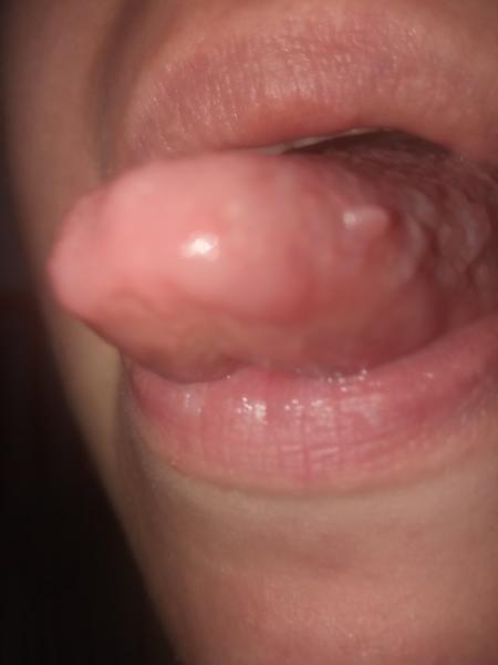 Je môj jazyk v poriadku?