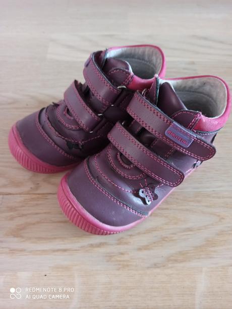 Dievčenské poltopánky, protetika,22