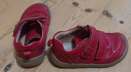 Protetika topanočky, protetika,25