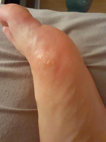 Čo to mám na nohe?