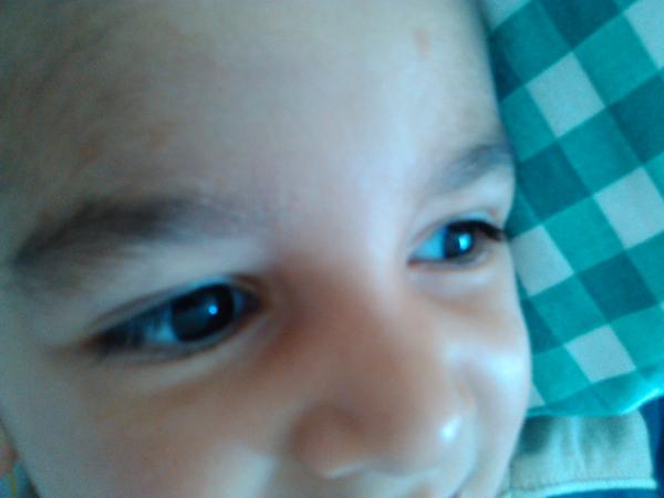 Olupovanie kože pod obočím