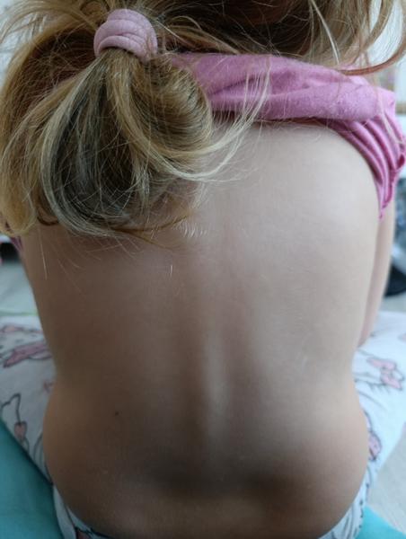 Je chrbtica mojej dcérky v poriadku?