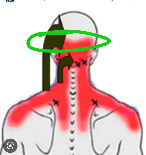 Majú aj vaše detičky takéto dve hrčky?