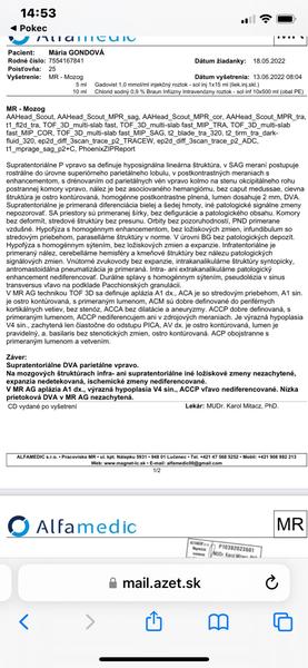 Aké sú moje výsledky?