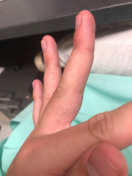 Môže byť moja alergia spôsobená mačkou?