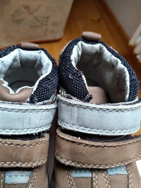 Jesenné topánočky, protetika,21